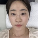 그리고 예뻐진 | 둔촌동 속눈썹펌 잘하는 곳 래쉬로그 ✨ 자연스럽게 예뻐진 솔직후기