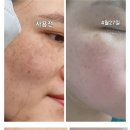 셀덤바이오 | 기미잡티 여드름트러블 안티에이징에 효과좋은 화장품 셀리진 소비자리얼후기 놀라지마세요!