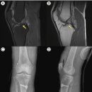 배가 당기고, 가스가 차는 증상 치험례. 기사 2025.9.15. 이미지
