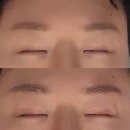 해운대 우신골든메르시앙 | 해운대 피부관리 더함 에스테틱 고통 없는 4D 윤곽관리