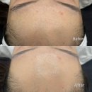 뉴 스킨 이미지