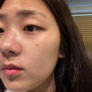 정다솜 | 미르테2바이예진 연예인 피부관리샵 청담피부관리 연예인 얼굴 크기 만들기 골드케어 후기