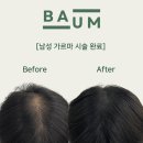 바움SMP