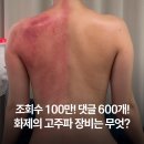 우리메디텍 | 고주파 기기 비교와 리쥬웨이브 부위별 사용 꿀팁(실제 사용 후기 공유)