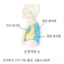 흉선암(Thymic Carcinoma) 환자가 참고하여야 할 치료와 관리 과정 이미지