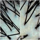 래미안 해운대 | [부산] 관리 day !! 해운대 두피디톡스 :: 올가드림뷰티 해운대래미안점