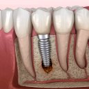 휴플란트치과의원 이미지