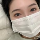 몽레쓸