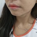 이노플러스성형외과의원 | 전주 이노병원 튀어나온점 빼기 전주 튀어나온점 제거 수술