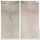 떡뜰날 | 군산왁싱 남자 배 ,가슴 왁싱 후기 수송동 리프레쉬 왁싱