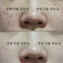 연세지움 Daum카페