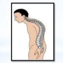 세움보조기 이미지