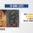 🍒 꿀에 살아있는 효소 가 있다는 것 알고 있었나요?// (깜짝) 귓불에 생긴 대각선 주름은 치매 위험 신호다⊙ㅁ⊙?! | 나는 몸신 이미지