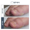 엔피(NP)케어 대전서구점