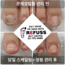 레푸스 이미지