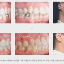 연세스마트치과의원 이미지