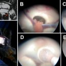 스마트폰으로 활용하는 인공지능 이미지