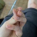 강남 브라질리언왁싱 잘하는 위치스터치
