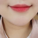 덴트천재