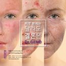 에스테틱신화;케이펄스킨 | 청주 피부관리 주기적으로 케이펄스킨에서 받아주고 있어요