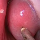 강남연세이비인후과의원 이미지