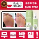 빅토리네일 | 무좀·습진 고민해결!! 풋케어 꿀템👣 👣 오존가드 스프레이