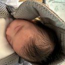 아이블리소아청소년과의원 | 저체중아 69일차 육아일기: 아이블리소아과, 지루성피부염