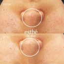 수정피부관리샵 이미지