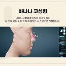 바나나성형외과의원 네이버블로그