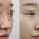 양동준성형외과 네이버블로그