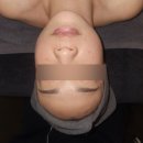 수연 | 김해피부관리 에스테틱 수연 시그니처 V-리프팅 후기｜김해목어깨관리까지