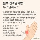 안수정형외과의원 | [공지] 인덕원 정형외과) 일상을 방해하는 통증, 손목건초염의 원인과 해결책