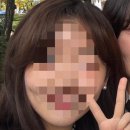 강남 신논현 튠페이스 리프팅 추천 탄력 안티에이징 후기