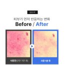 딕트