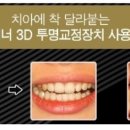 목동중앙치과병원 네이버블로그