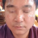미현 인셀덤 | 피부미용 1차 체험 인셀덤화장품 남궁미현
