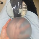 뭐?내가 유방암이라고?? 아산병원 검사결과 및 성형외과 진료