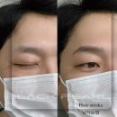 블랙펄헤어 | 대전눈썹문신 블랙펄 오래된 눈썹 흉터 반영구로 커버한 후기