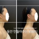 예쁜여우피부관리 | 얼굴 작아지는법 동안 얼굴 위뷰티예쁜얼굴 피부관리 받고 온 후기!