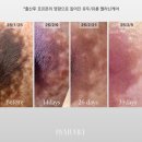 순강길 | 인천바이뮬리 멜라닌케어 사장이 직접 경험한 솔직 후기