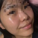 수야에스테틱 | 위글랜 진생리페어 속광앰플 속건조 해결! 예비신부 홈케어 속광템 후기
