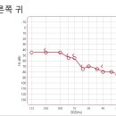 벨톤보청기 중곡지사 이미지