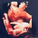 신광의료기기 | 이대서울병원 정기진료 :: Tdap 예방접종 :: 액상철분제(볼그레), 의료용 압박스타킹(독일 베넥스) 처방