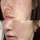 시네마의원 | 논현역피부과 시네마의원 색소레이저 잘하는 곳 추천