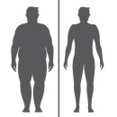 암 수술 후… 저체중 VS 비만, 누가 오래 살까? 이미지