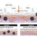 오투테라피