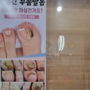 루덴네일