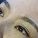 더블류성형외과 네이버블로그