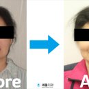 세움치과기공소 네이버블로그