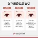 꼼꼼성형외과의원 이미지